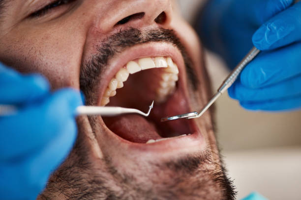 Best Emergency TMJ Treatment in Rosharon, TX