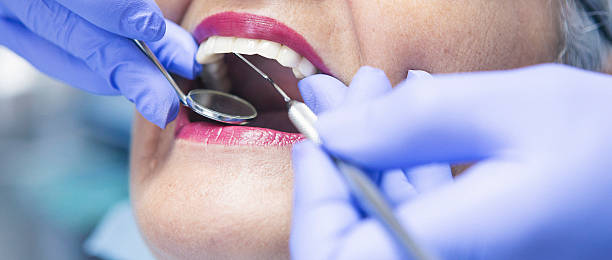 Best Emergency Treatment for Dental Infections or Abscesses in Rosharon, TX